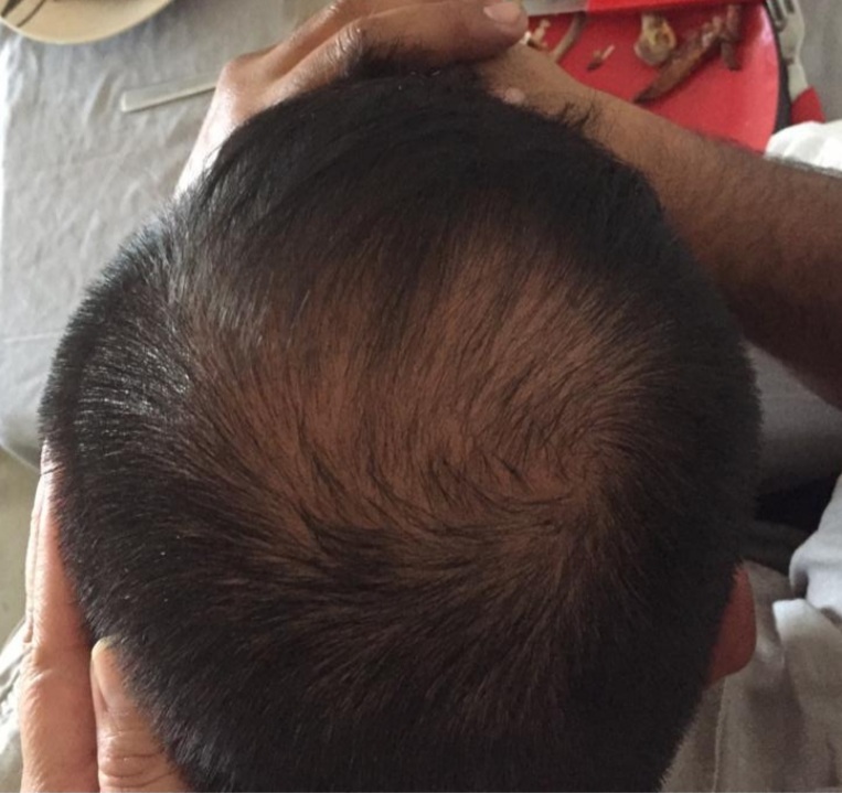 NANOPARTÍCULAS DE COBRE EN EL SHAMPOO PARA LA CAÍDA DEL CABELLO EL REVOLUCIONARIO PRODUCTO COSMÉTICO