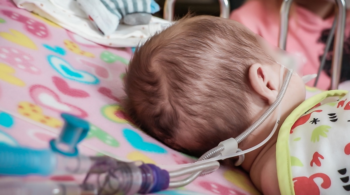 HOSPITAL REGIONAL EVITA EN MÁS DE UN 90 EL USO DE VENTILACIÓN MECÁNICA INVASIVA EN NIÑOS CON INSUFICIENCIA RESPIRATORIA MODERADA 2 copia