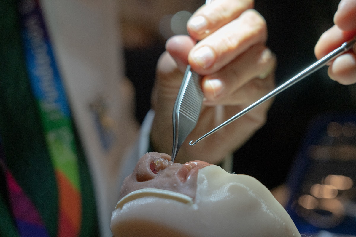 SIMULARE MEDICAL TECNOLOGÍA DE IMPRESIÓN 3D AYUDA A ENTRENAR A MÉDICOS DE CHILE Y DEL MUNDO PARA TRATAR LA FISURA LABIO PALATINA 2